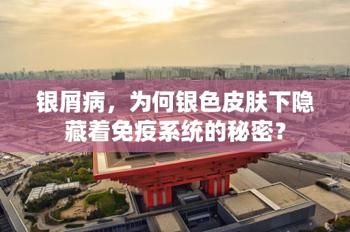 银屑病，为何银色皮肤下隐藏着免疫系统的秘密？